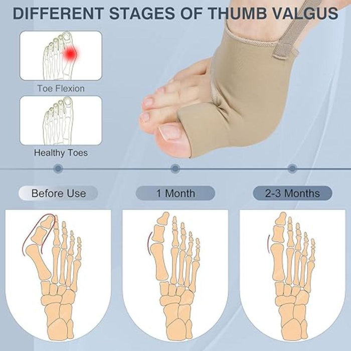 1 Pair Orthopedic Bunion Relief Socks - Hallux Valgus Correction - SOCKZ