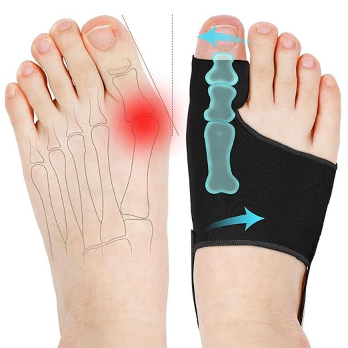 1 Pair Orthopedic Bunion Relief Socks - Hallux Valgus Correction - SOCKZ
