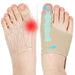1 Pair Orthopedic Bunion Relief Socks - Hallux Valgus Correction - SOCKZ